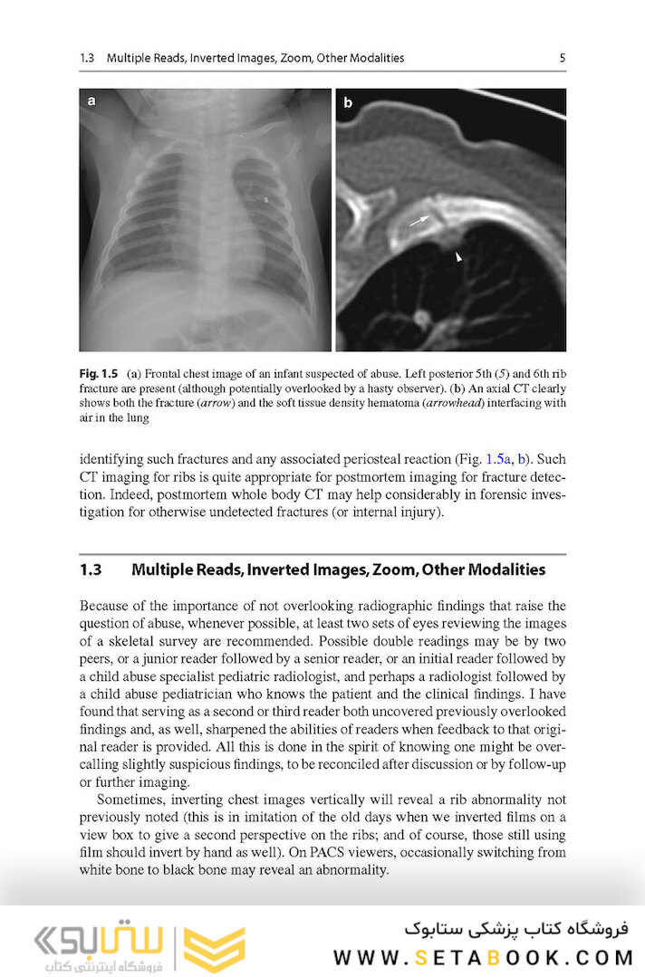 Recognizing Child Abuse in Radiology 1st ed. 2017 Edicion