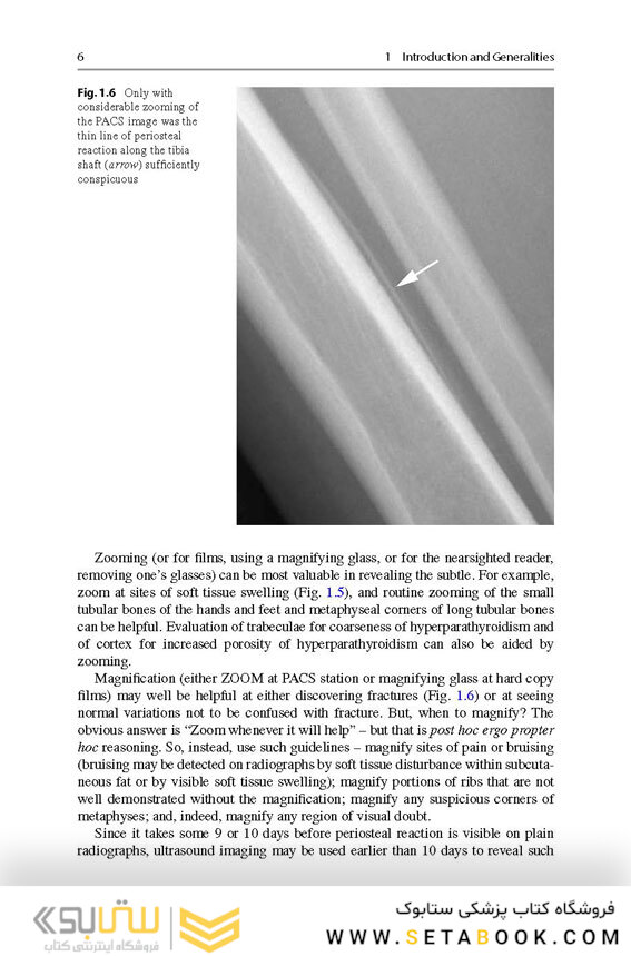 Recognizing Child Abuse in Radiology 1st ed. 2017 Edicion