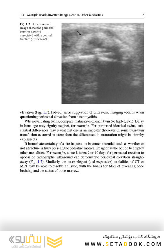 Recognizing Child Abuse in Radiology 1st ed. 2017 Edicion