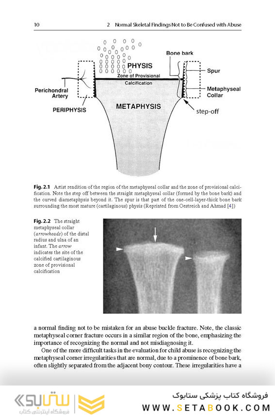 Recognizing Child Abuse in Radiology 1st ed. 2017 Edicion