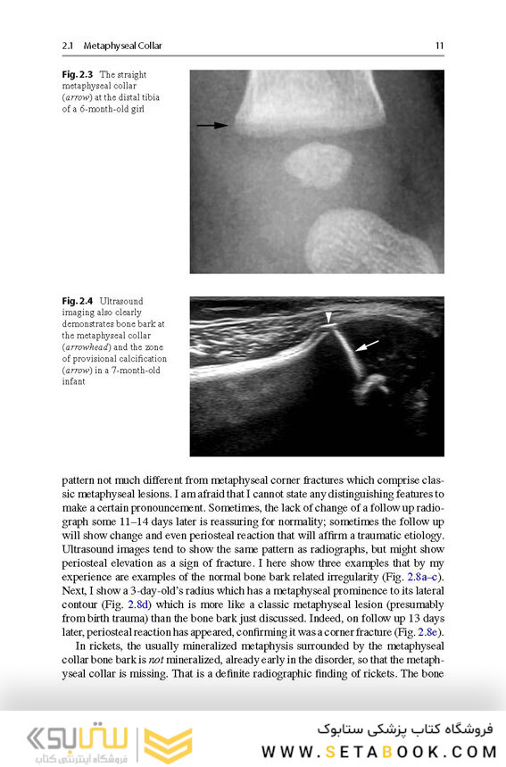 Recognizing Child Abuse in Radiology 1st ed. 2017 Edicion