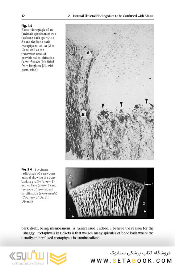 Recognizing Child Abuse in Radiology 1st ed. 2017 Edicion