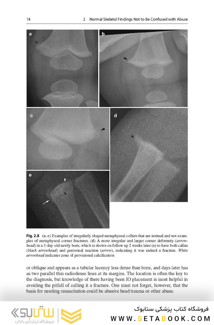 Recognizing Child Abuse in Radiology 1st ed. 2017 Edicion