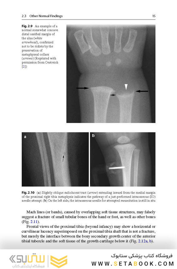 Recognizing Child Abuse in Radiology 1st ed. 2017 Edicion