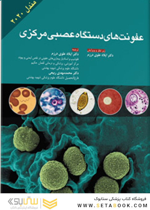 عفونت های دستگاه عصبی مرکزی مندل 2020