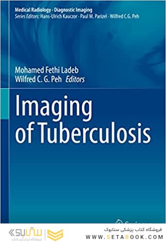 Imaging of Tuberculosis