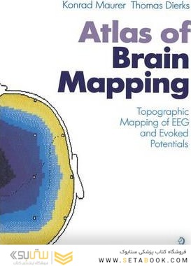 Atlas of Brain Mapping : Topographic Mapping of Electroencephalography and Evoked Potentials
