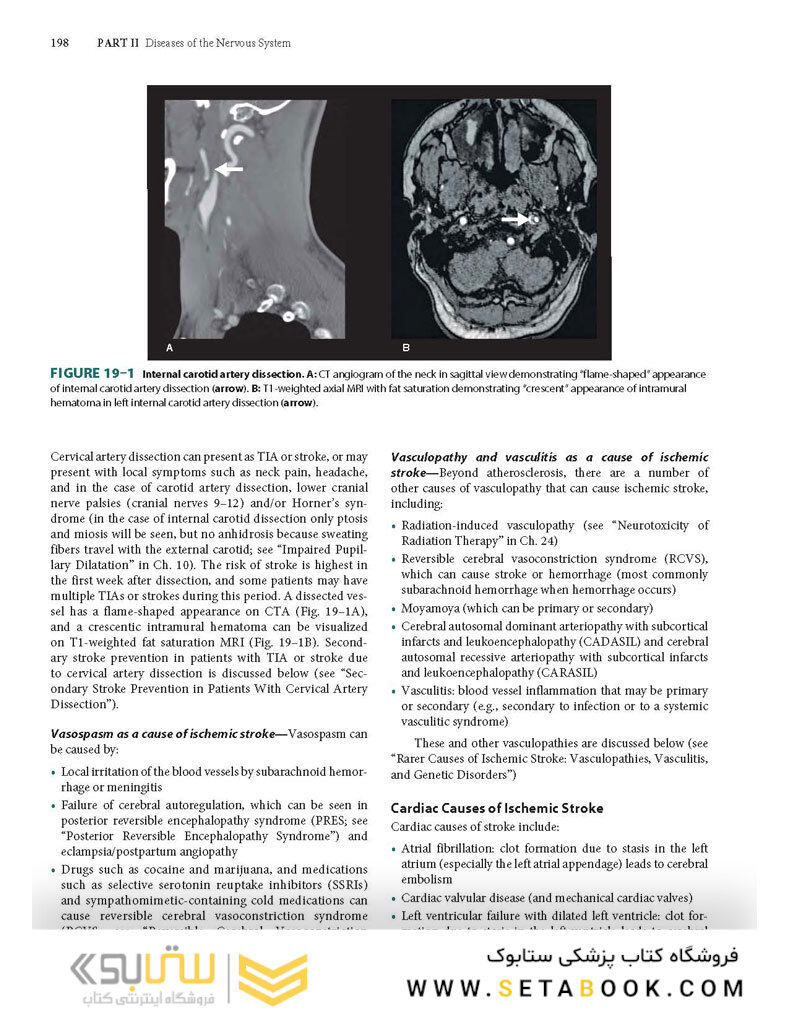Clinical Neurology and Neuroanatomy: A Localization-Based Approach, Second Edition 2nd Edition