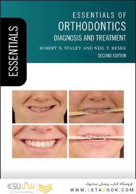 Essentials of Orthodontics : Diagnosis and Treatment