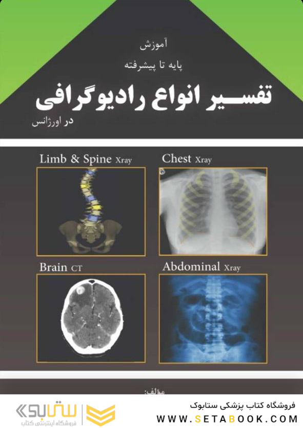 آموزش پایه تا پیشرفته تفسیر انواع رادیوگرافی در اورژانس
