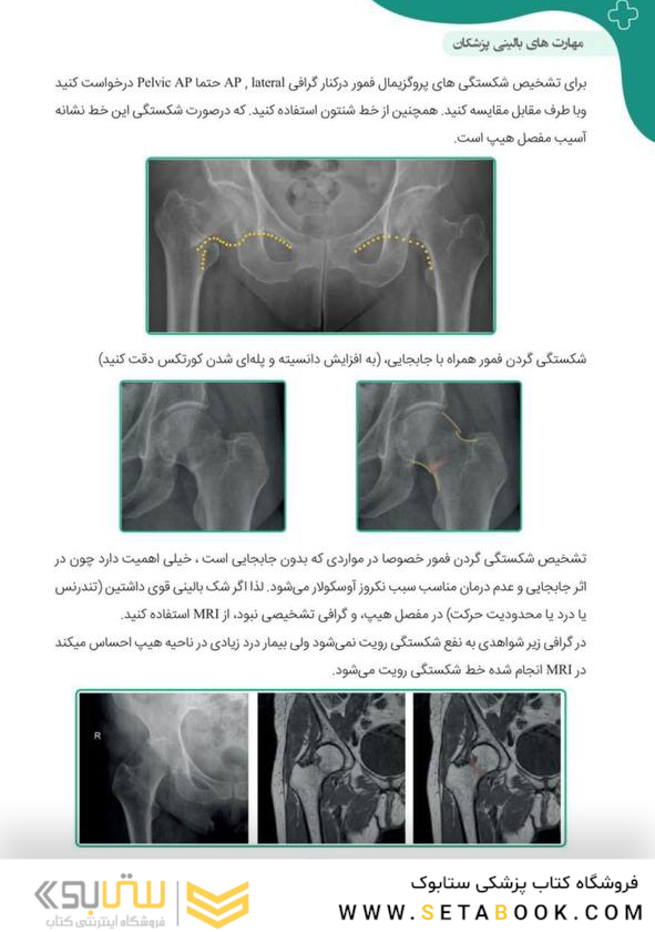 آموزش پایه تا پیشرفته تفسیر انواع رادیوگرافی در اورژانس