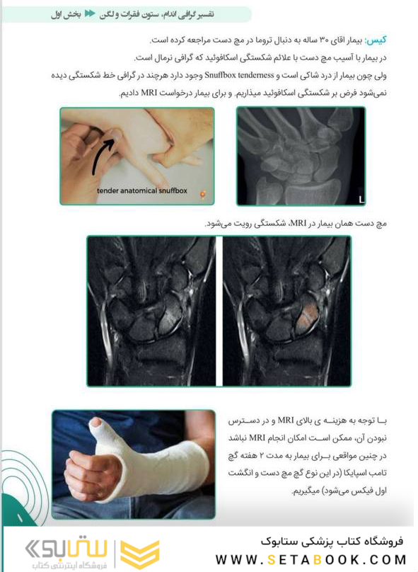 آموزش پایه تا پیشرفته تفسیر انواع رادیوگرافی در اورژانس