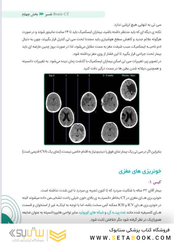 آموزش پایه تا پیشرفته تفسیر انواع رادیوگرافی در اورژانس