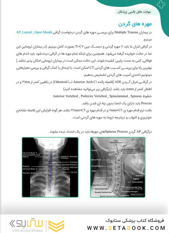 آموزش پایه تا پیشرفته تفسیر انواع رادیوگرافی در اورژانس