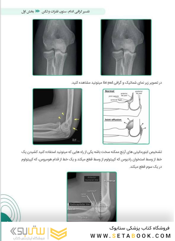 آموزش پایه تا پیشرفته تفسیر انواع رادیوگرافی در اورژانس