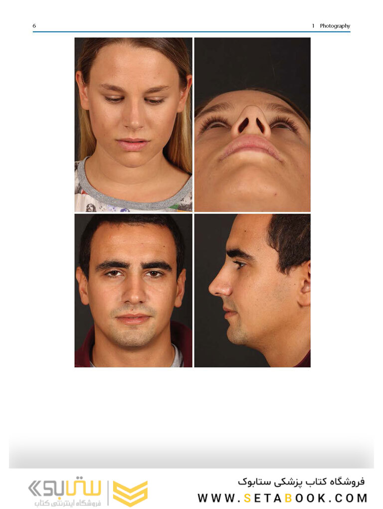 Aesthetic Septorhinoplasty 2021