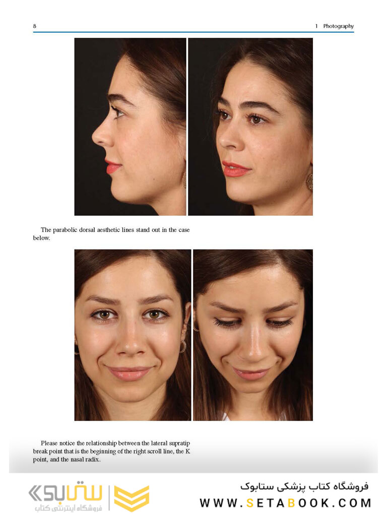 Aesthetic Septorhinoplasty 2021