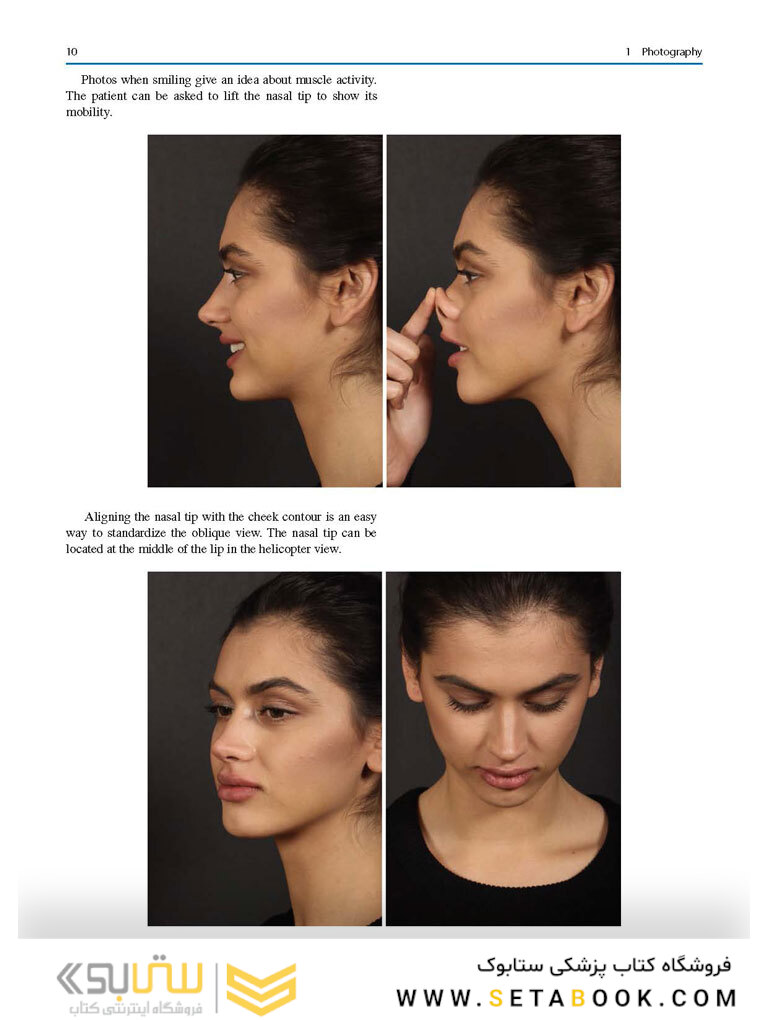 Aesthetic Septorhinoplasty 2021