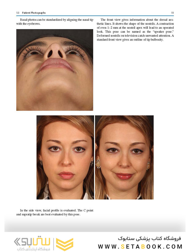 Aesthetic Septorhinoplasty 2021