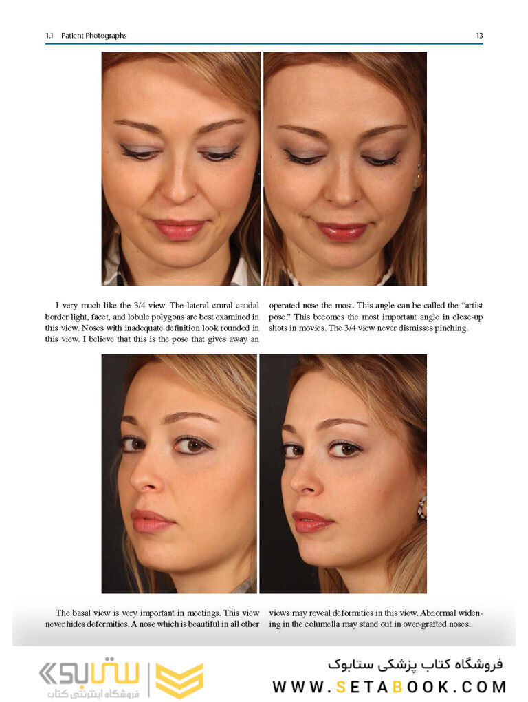 Aesthetic Septorhinoplasty 2021