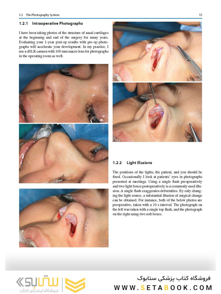 Aesthetic Septorhinoplasty 2021