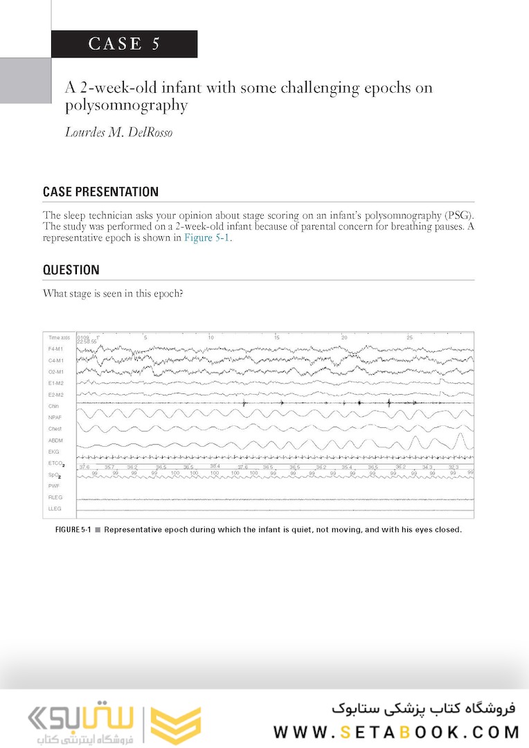 Pediatric Sleep Pearls