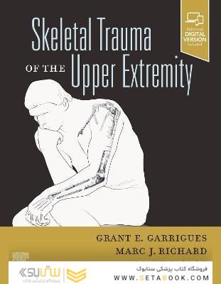 Skeletal Trauma of the Upper Extremity
