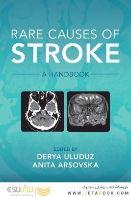 Rare Causes of Stroke: A Handbook