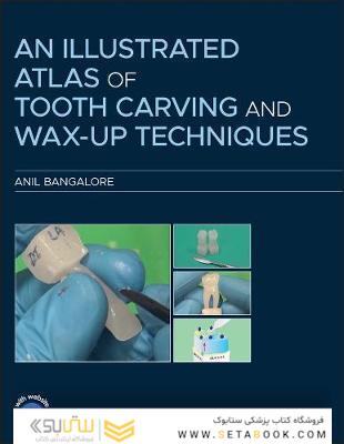 An Illustrated Atlas of Tooth Carving and Wax-Up Techniques