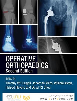 Operative Orthopaedics