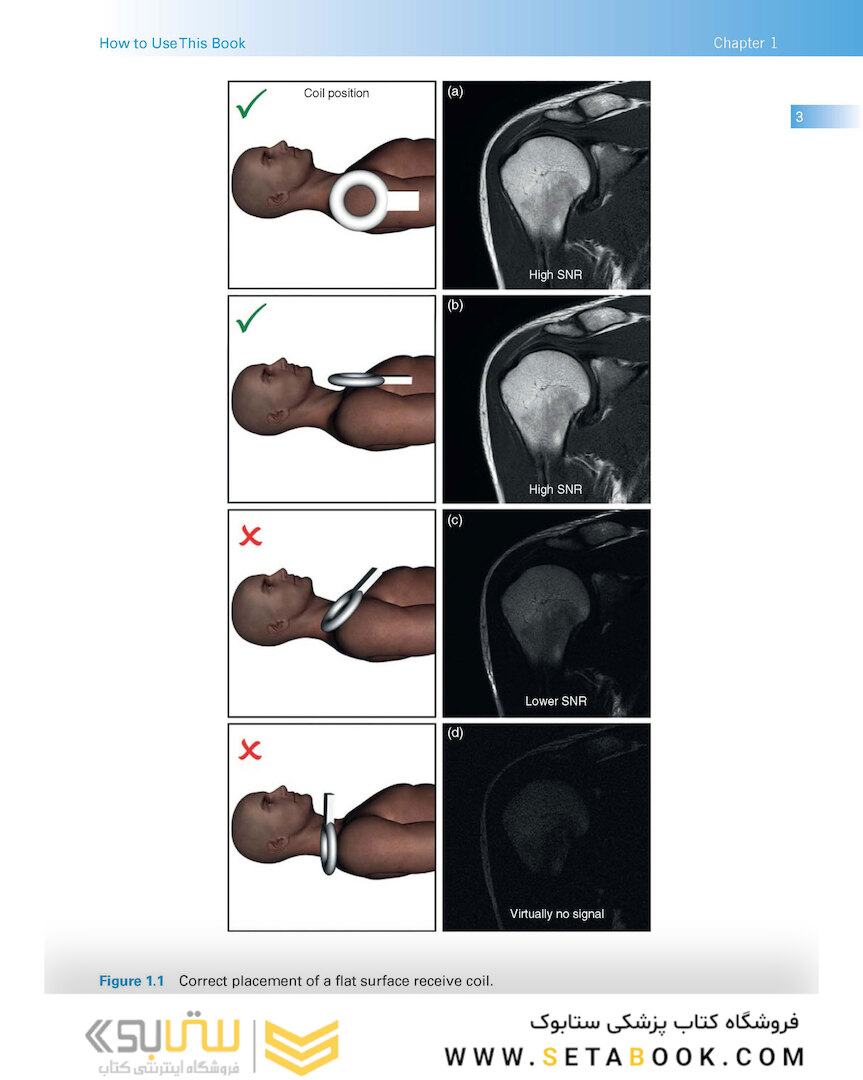 Handbook of MRI Technique 2022