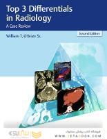 Top 3 Differentials in Radiology: A Case Review