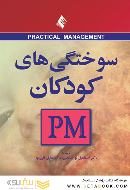 سوختگی های کودکان pm