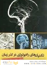 تکنیک های رادیولوژی در گذر زمان