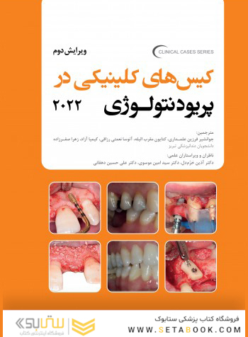 کیس های کلینیکی در پریودنتولوژی 2022