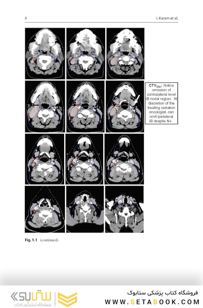 Target Volume Delineation and Field Setup : A Practical Guide for Conformal and Intensity-Modulated Radiation Therapy