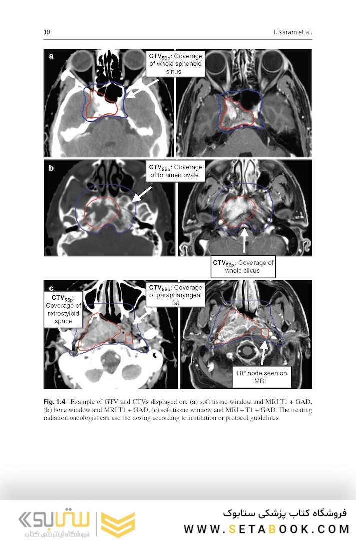 Target Volume Delineation and Field Setup : A Practical Guide for Conformal and Intensity-Modulated Radiation Therapy