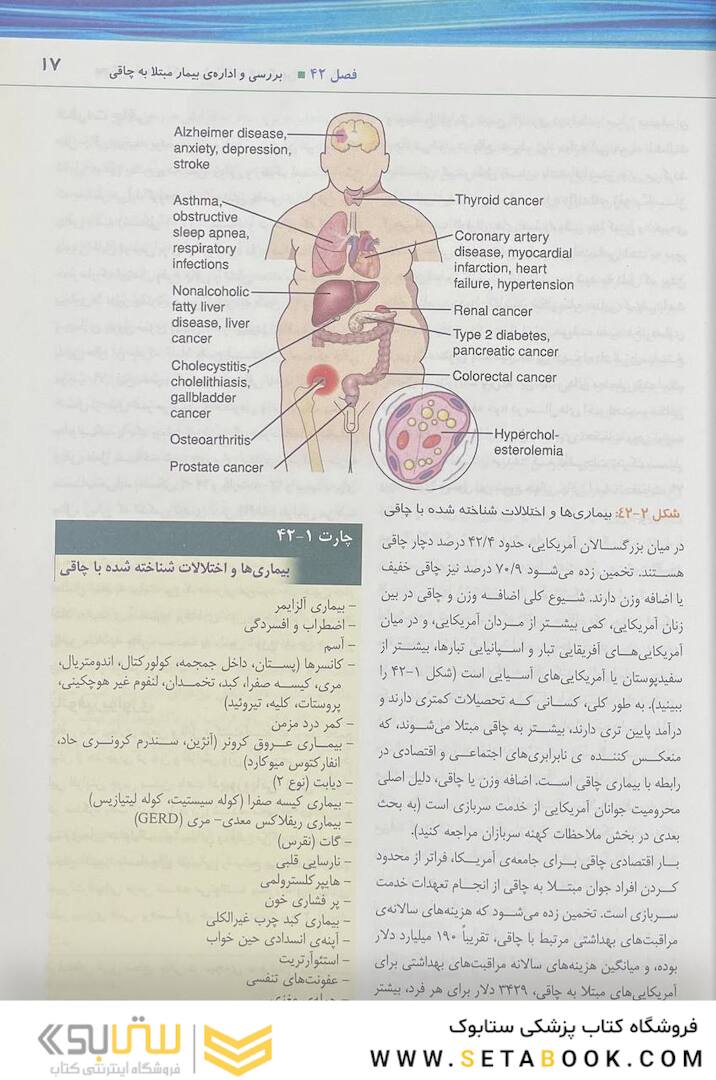پرستاری داخلی و جراحی برونر و سودارث 2022 متابولیسم و اندوکرین جلد 10