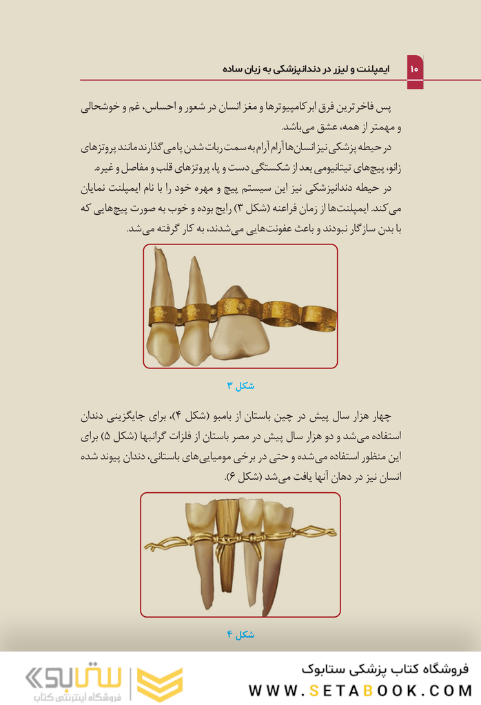 ایمپلنت و لیزر در دندانپزشکی به زبان ساده