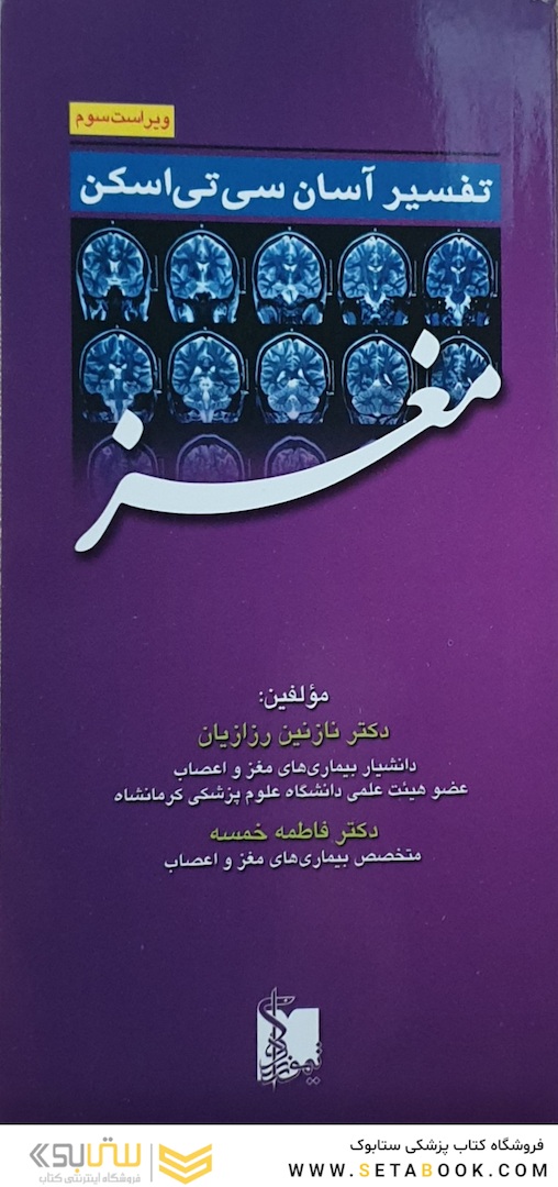 تفسیر آسان سی تی اسکن مغز