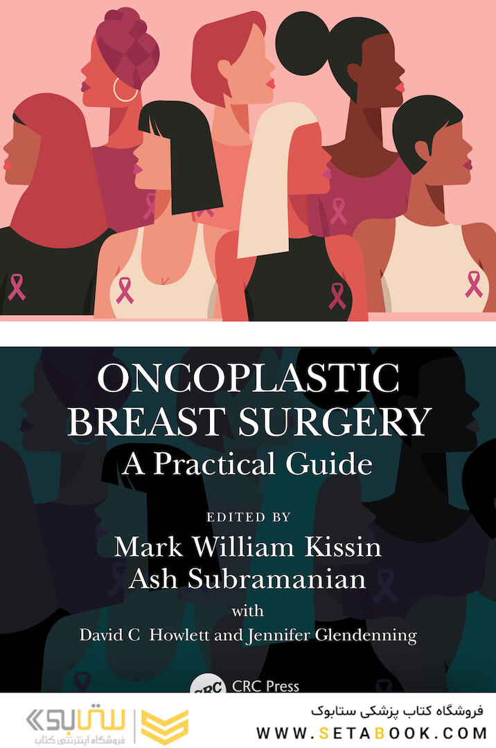 Oncoplastic Breast Surgery: A Practical Guide 1st Edicion