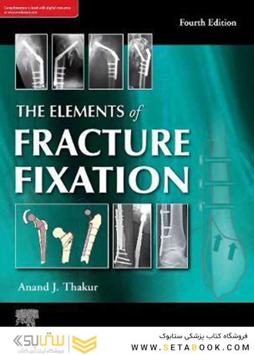 The elements of fracture fixation, 4e Kindle Edition