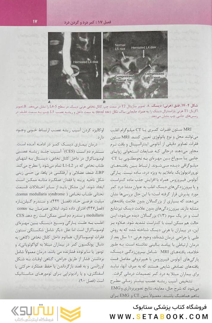 ترجمه کامل هاریسون 2022 بیماری  های روماتولوژی