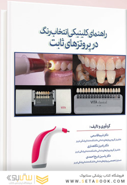 راهنمای کلینیکی انتخاب رنگ در پروتزهای ثابت