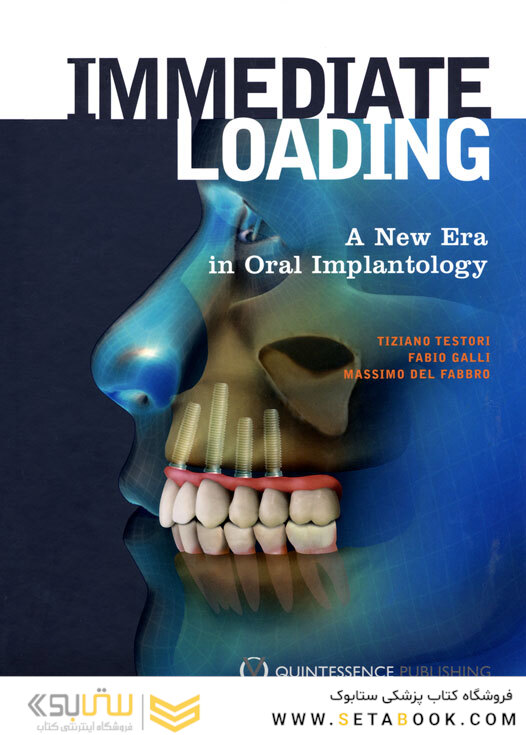 Immediate Loading: A New Era in Oral Implantology 1st Edicion