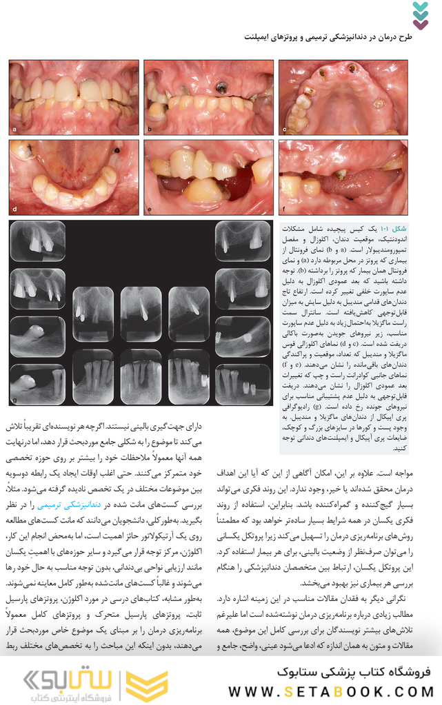 طرح درمان در دندانپزشکی ترمیمی و پروتزهای ایمپلنت