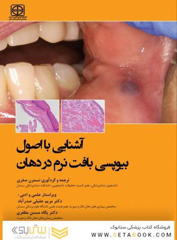 آشنایی با اصول بیوپسی بافت نرم در دهان