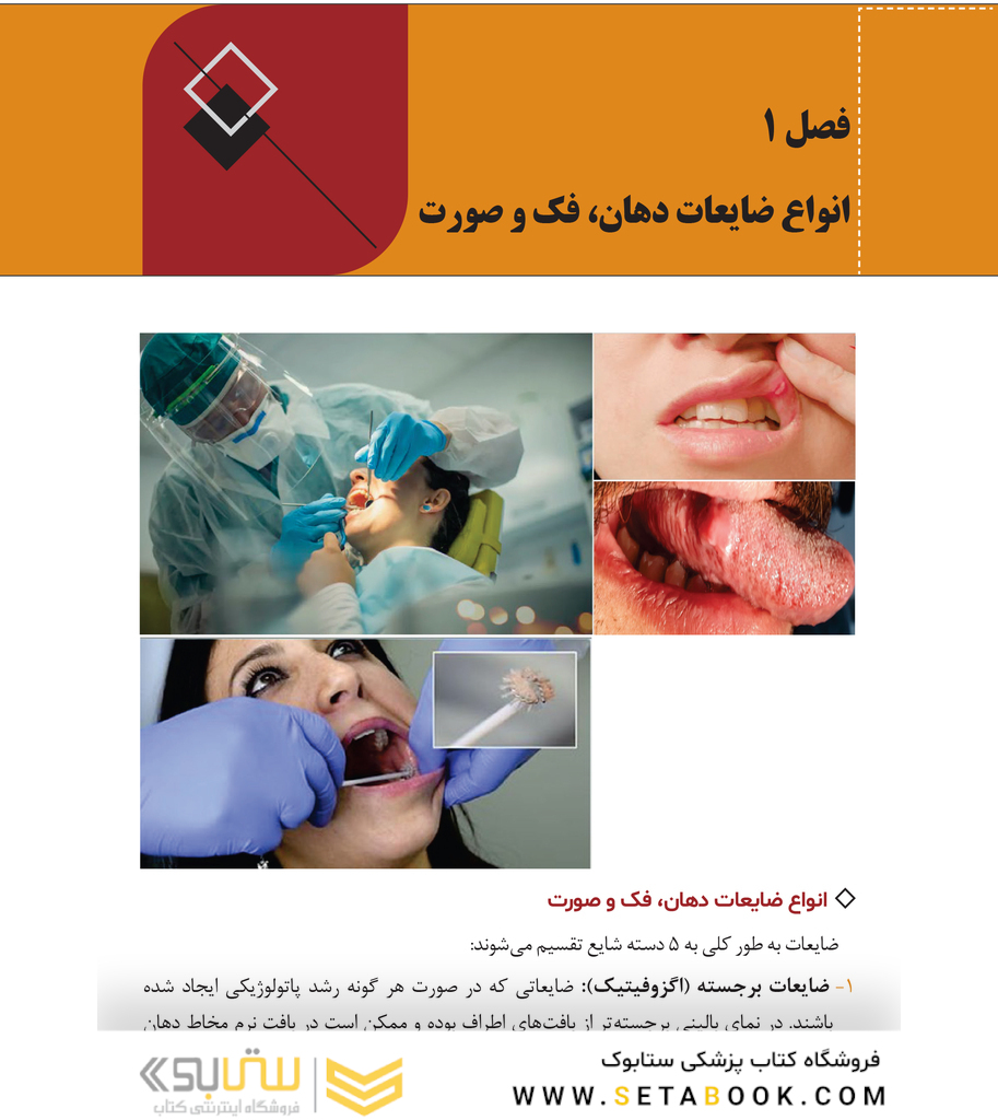 آشنایی با اصول بیوپسی بافت نرم در دهان