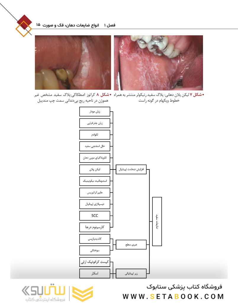 آشنایی با اصول بیوپسی بافت نرم در دهان