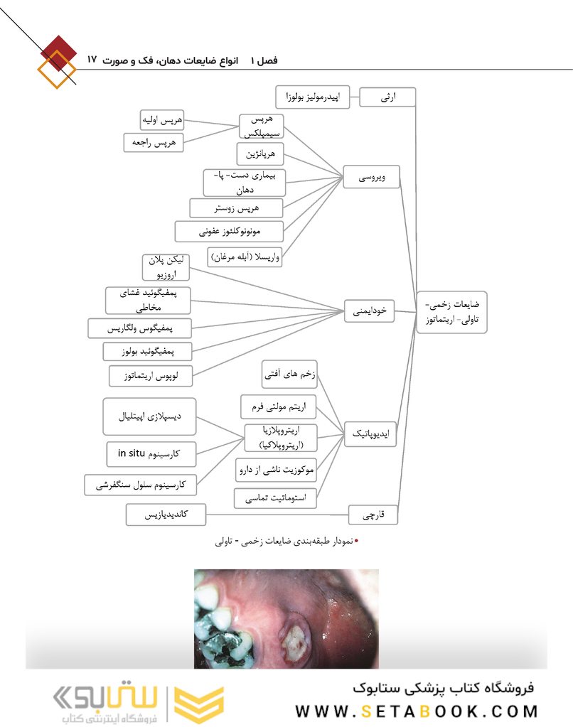 آشنایی با اصول بیوپسی بافت نرم در دهان